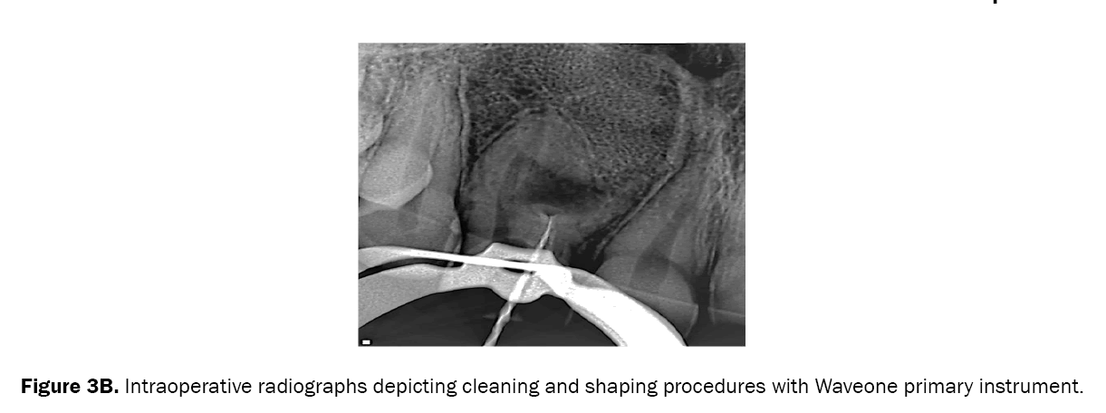 dental-sciences-cleaning-shaping-procedures