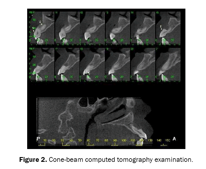 dental-sciences-cone-beam-computed