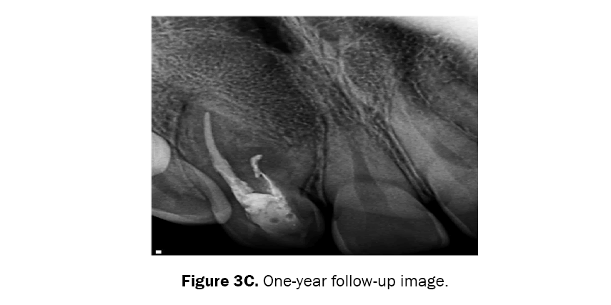 dental-sciences-one-year-follow-up