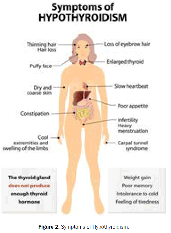 medical-health-sciences-symptoms-hypothyroidism