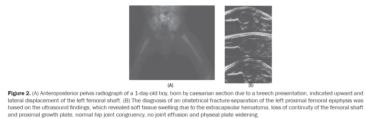 orthopedics-caesarian-section